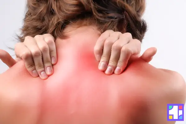 قرمزی و واکنش های آلرژیک پوستی از عوارض فیزیوتراپی محسوب می شود.