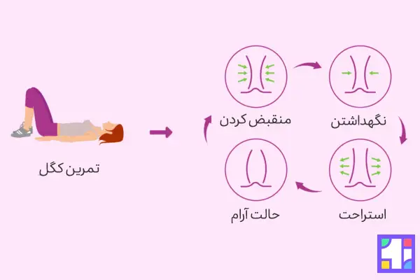 تمرین کگل بهترین تمرین برای تقویت عضلات شکم و کمر در دوران بارداری است.