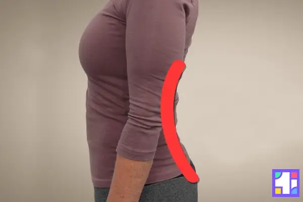 گودی کمر یا لوردوز کمری عامل ایجاد درد در پایین کمر است.