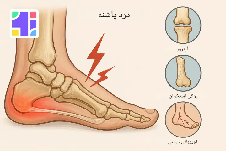 بیماری های موثر در درد پاشنه پا