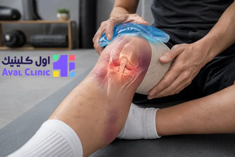 اقدامات مهم بعد از پیچ خوردن زانو